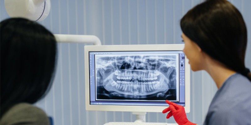 عکس OPG چه کاربردهایی در دندانپزشکی دارد ؟