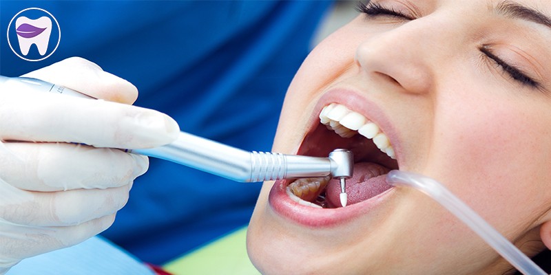 مواد پر کردنی دندان چه ویژگی هایی دارد