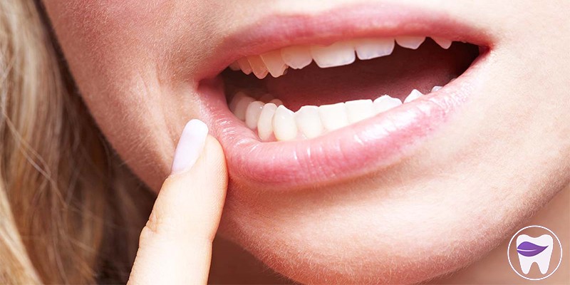 آیا جراحی دندان عقل نهفته کار درستی است ؟