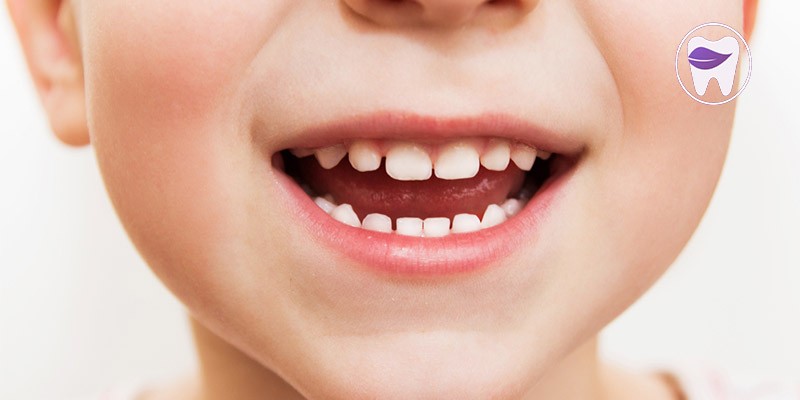 قطره آهن یکی از دلایل پوسیدگی دندان است