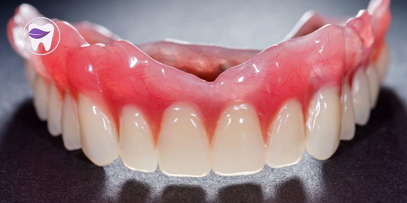 دندان مصنوعی یک روش برای جایگزینی دندان های از دست رفته است