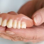 دندان مصنوعی یک روش برای جایگزینی دندان