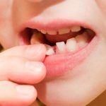 لق شدن دندان کودکان را جدی بگیریم