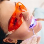 علت استفاده از دستگاه لایت کیور در دندانپزشکی