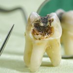 پالپ دندان داخلی ترین قسمت دندان