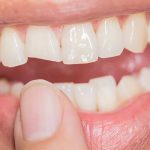 ترومای دندانی و ضربه هایی که به دندان وارد میشود ؟