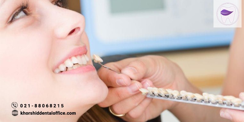 مراقبت از لمینت دندان چه نکاتی دارد ؟