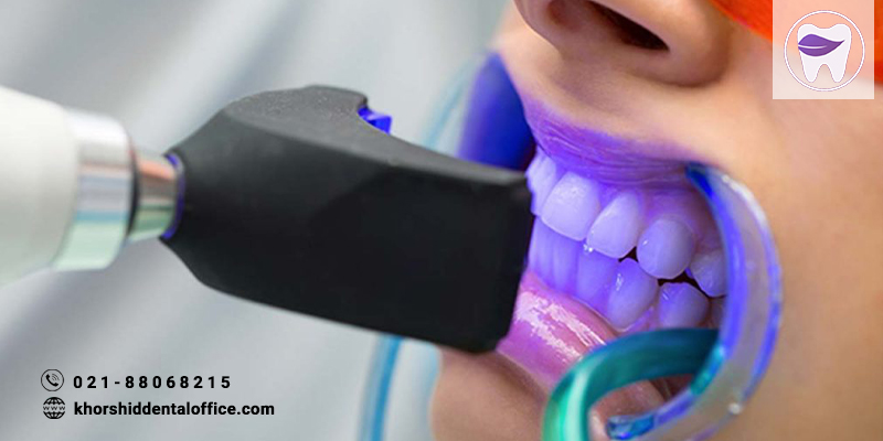 دستورالعمل های طولانی مراقبت بعد از بلیچینگ دندان