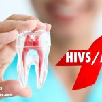 ایدز و ارتباط آن با بهداشت دهان و دندان