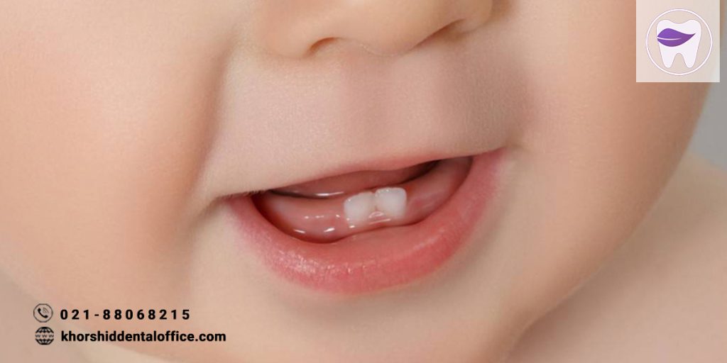 مراحل رویش دندان کودکان چگونه است ؟