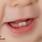 مراحل رویش دندان کودکان چگونه است ؟