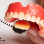 علت استفاده از دندان مصنوعی در جوانی چیست ؟