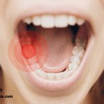 علایم و نشانه های دندان درد عصبی که لازم است بدانید