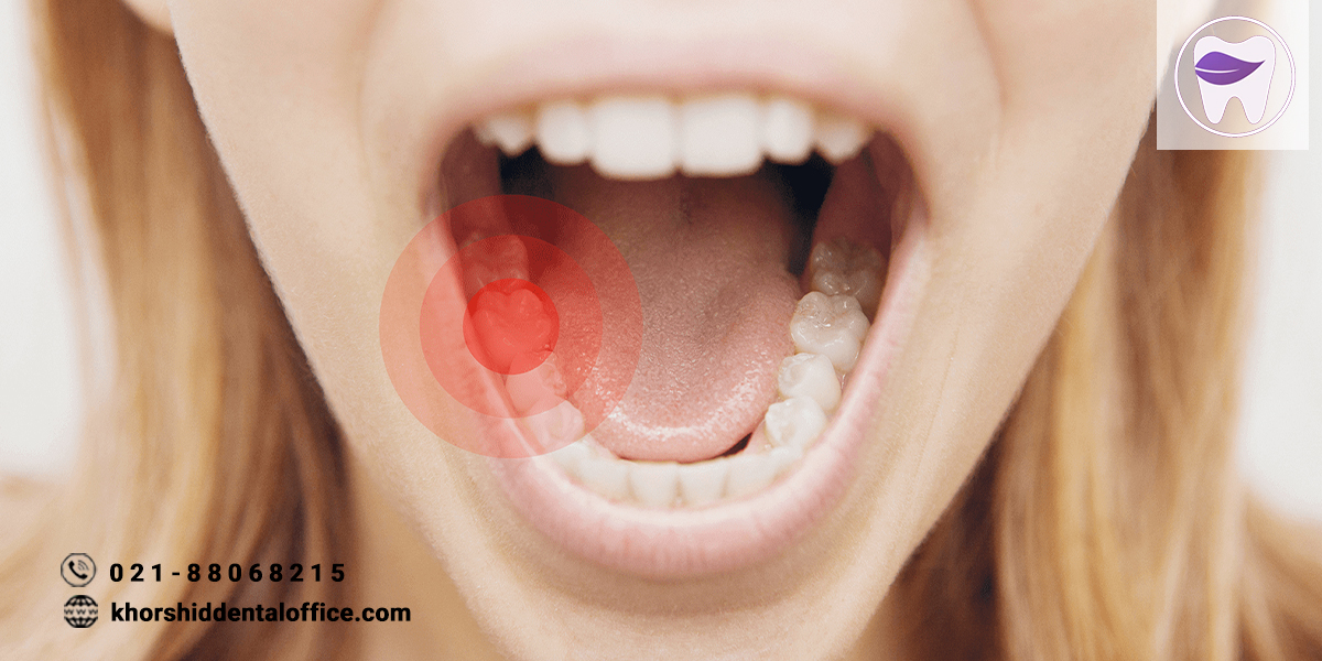 علایم و نشانه های دندان درد عصبی که لازم است بدانید