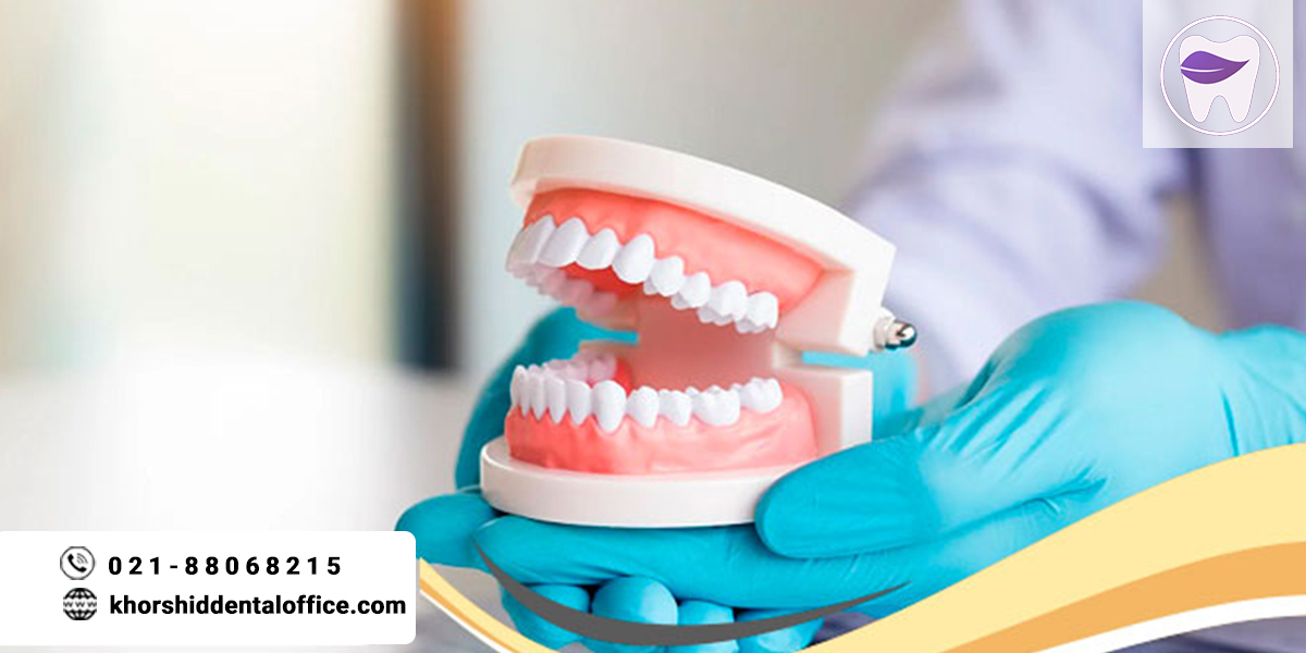 عوامل موثر در قیمت پروتز دندان کدام است ؟