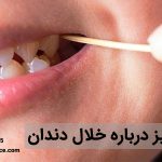 آیا استفاده از خلال دندان کار درستی است ؟