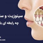 سینوزیت چه تاثیری در سلامت دندان ها دارد ؟