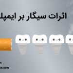 آیا میدانید که اثرات سیگار و ایمپلنت دندان چیست ؟