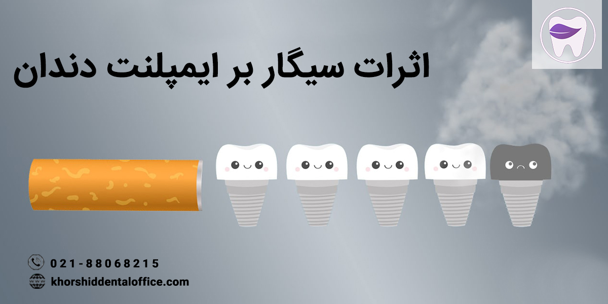 آیا میدانید که اثرات سیگار و ایمپلنت دندان چیست ؟